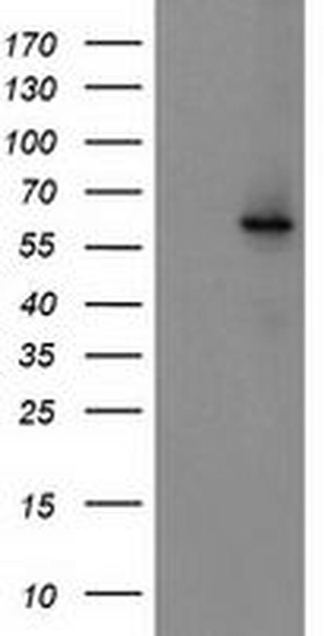 CYP2J2 Antibody in Western Blot (WB)