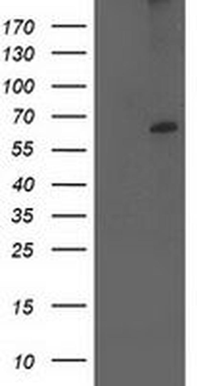 CYP2J2 Antibody in Western Blot (WB)