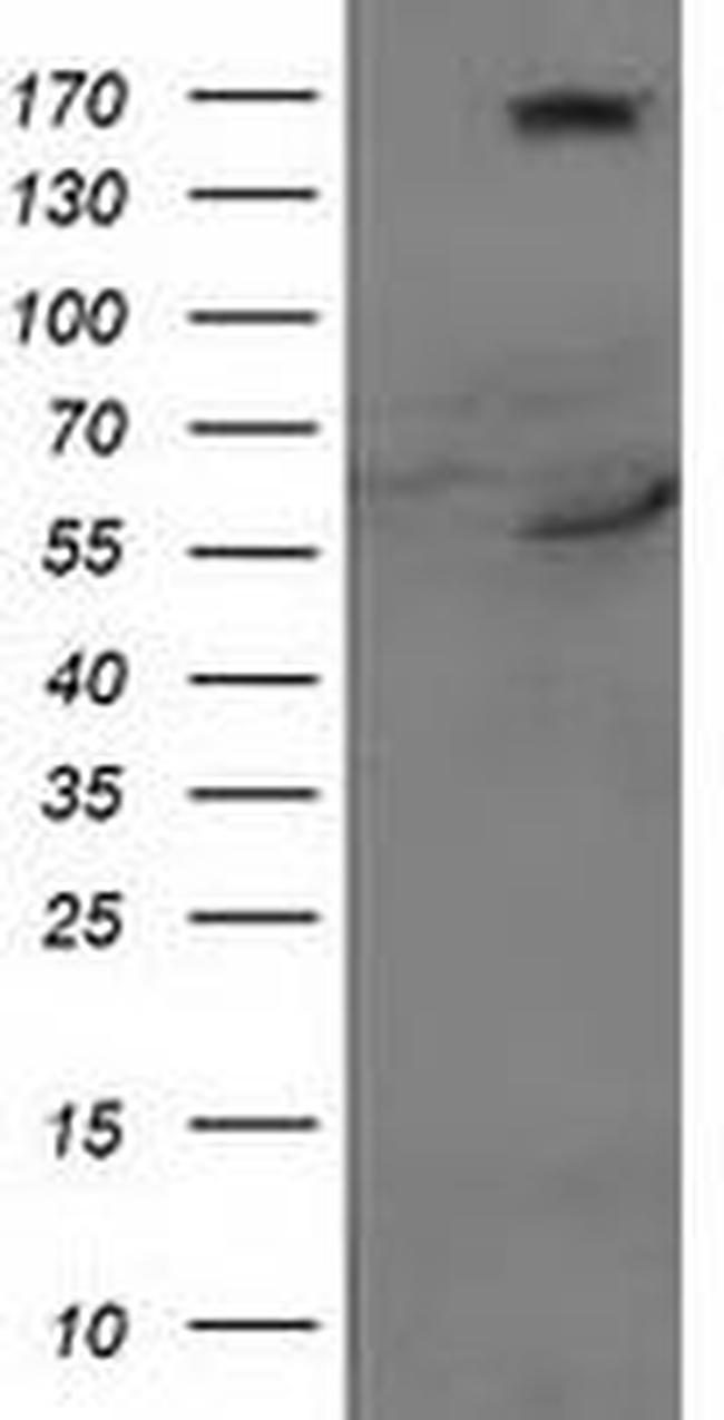 CYP2J2 Antibody in Western Blot (WB)