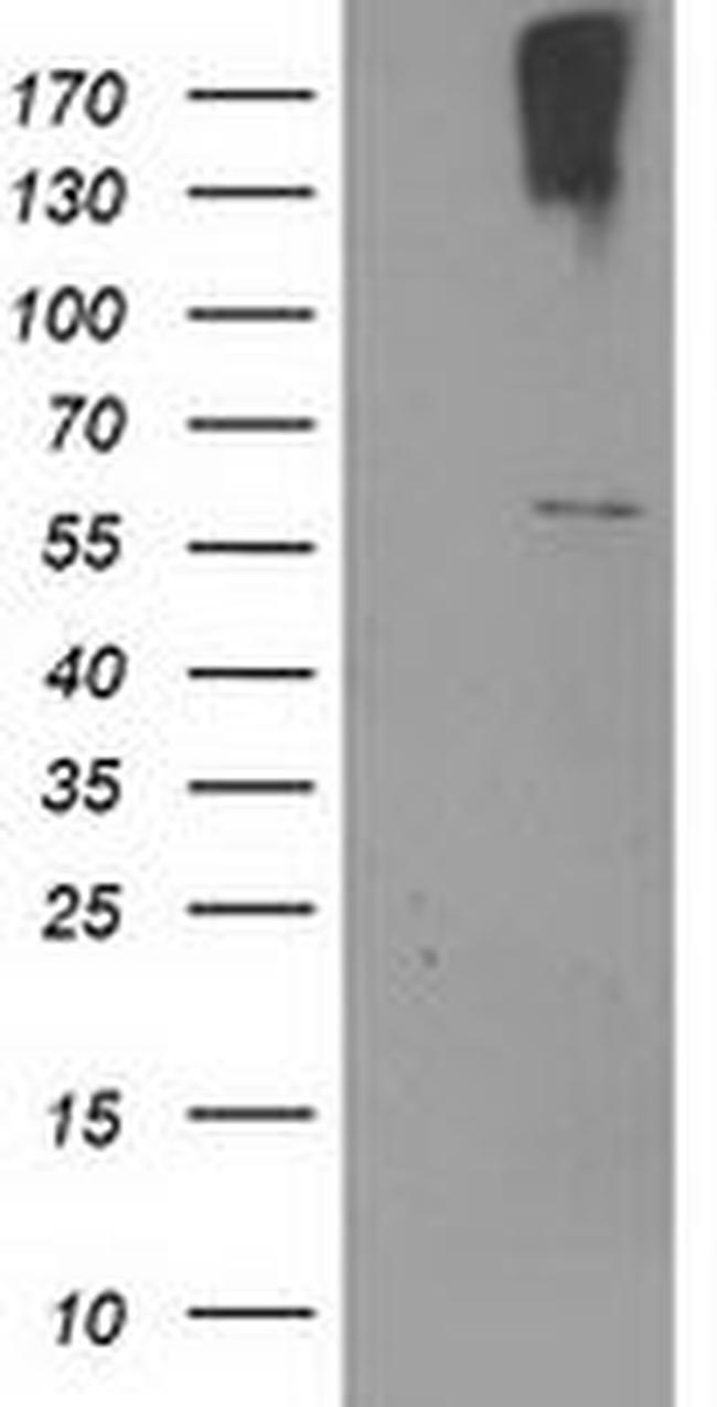 CYP2J2 Antibody in Western Blot (WB)