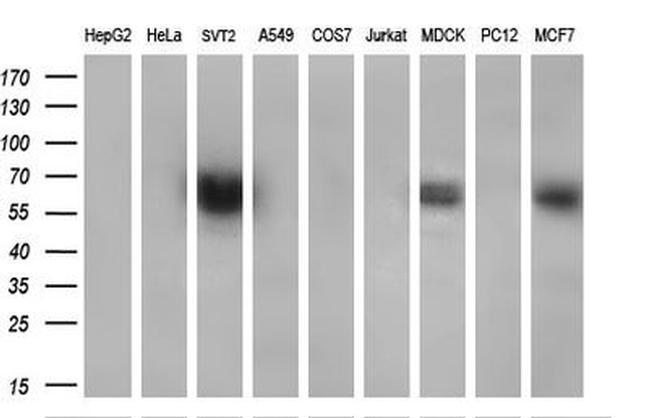 CYP2J2 Antibody in Western Blot (WB)