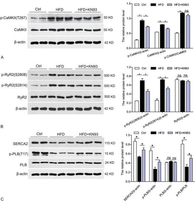 Phospho-CaMKII beta/gamma/delta (Thr287) Antibody in Western Blot (WB)