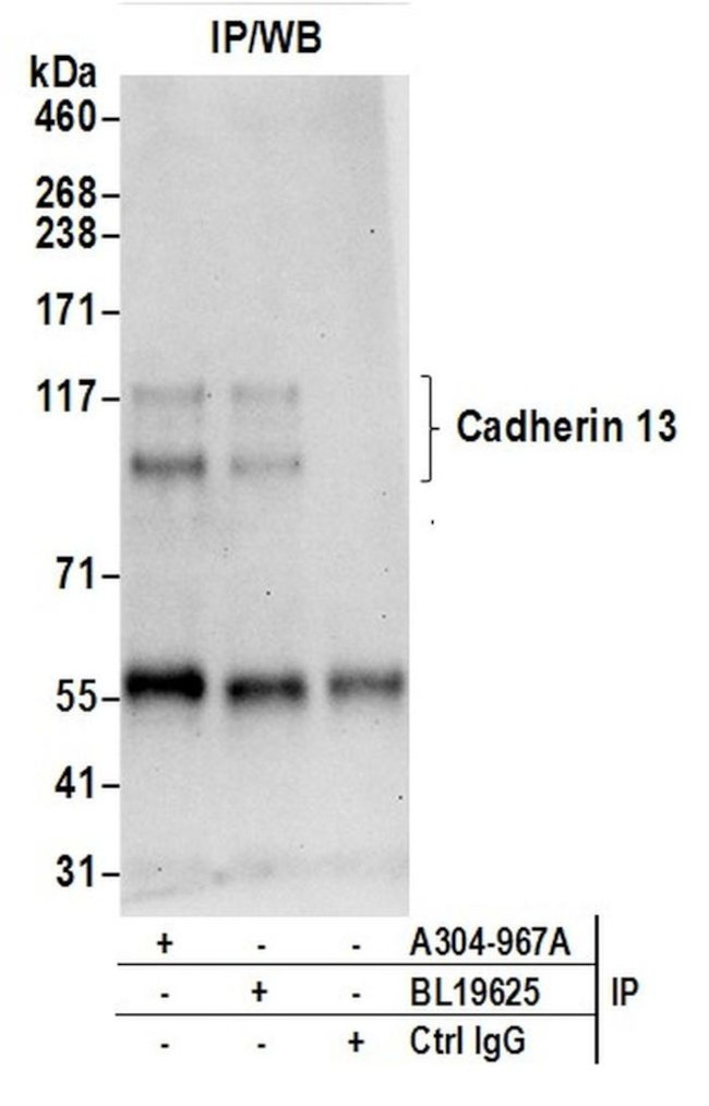 Cadherin 13/CDH13/T-cadherin Antibody in Immunoprecipitation (IP)