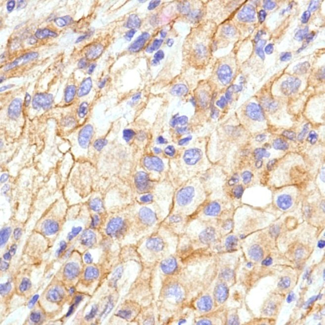 N-cadherin Antibody in Immunohistochemistry (Paraffin) (IHC (P))