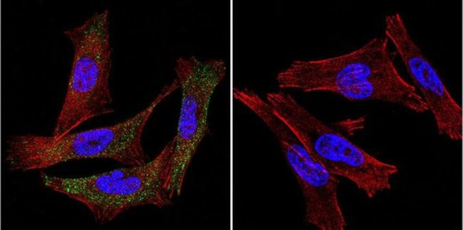 P-cadherin Antibody in Immunocytochemistry (ICC/IF)