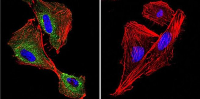 P-cadherin Antibody in Immunocytochemistry (ICC/IF)