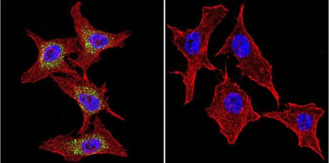 P-cadherin Antibody in Immunocytochemistry (ICC/IF)