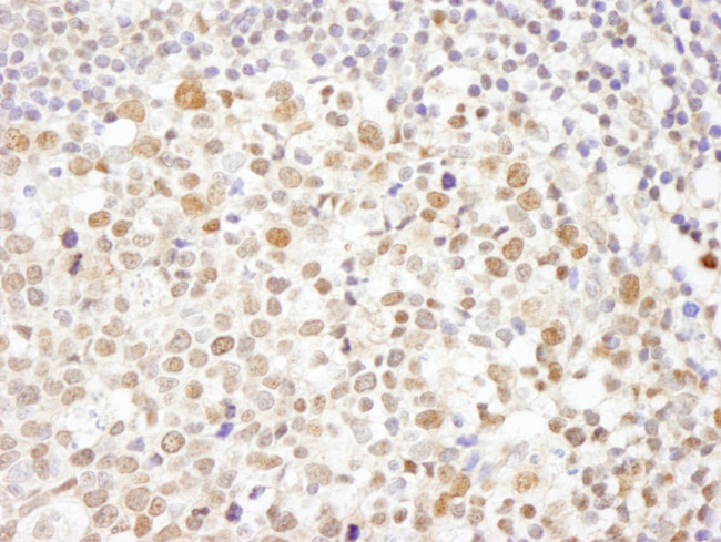 Caf1p150 Antibody in Immunohistochemistry (IHC)