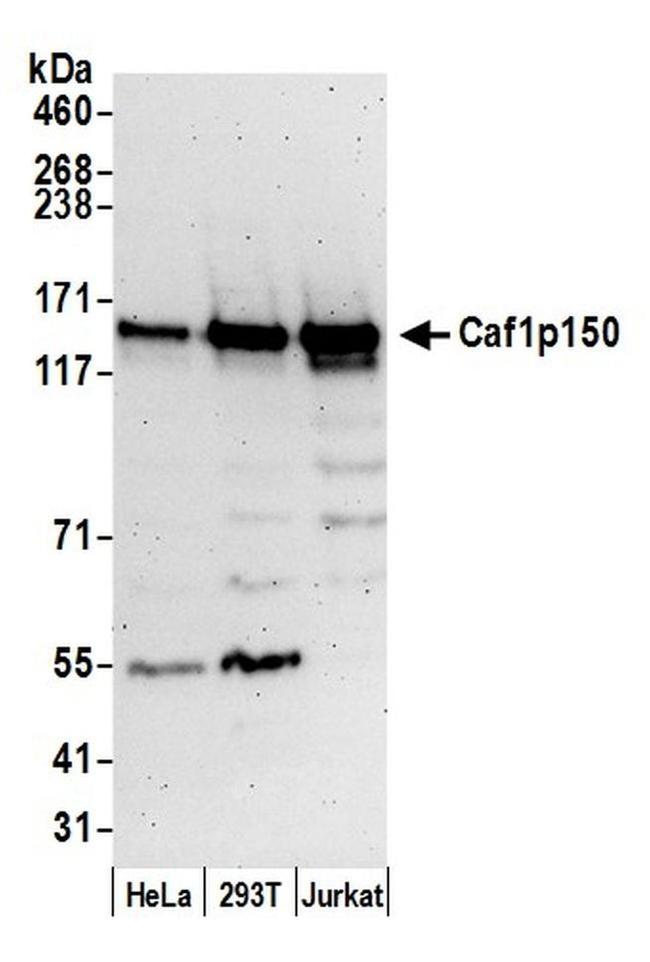 Caf1p150 Antibody in Western Blot (WB)