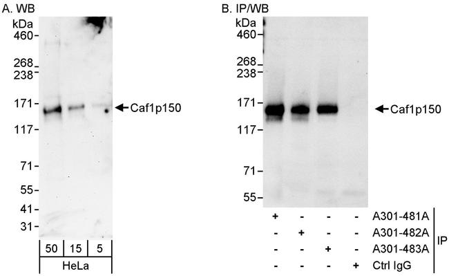 Caf1p150 Antibody in Western Blot (WB)