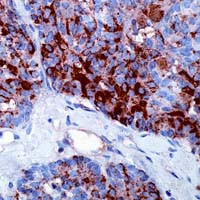 Calcitonin Antibody in Immunohistochemistry (Paraffin) (IHC (P))