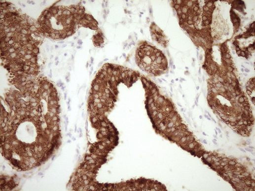 Calcitonin (CALCA) Antibody in Immunohistochemistry (Paraffin) (IHC (P))