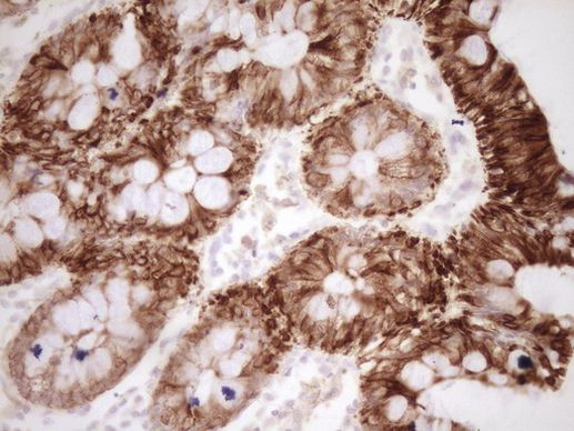 Calcitonin (CALCA) Antibody in Immunohistochemistry (Paraffin) (IHC (P))