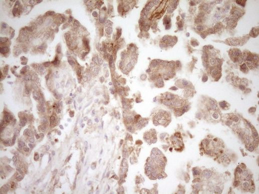 Calcitonin (CALCA) Antibody in Immunohistochemistry (Paraffin) (IHC (P))