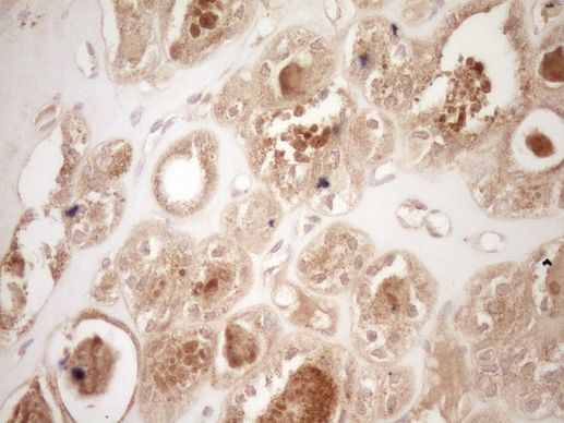 Calcitonin (CALCA) Antibody in Immunohistochemistry (Paraffin) (IHC (P))