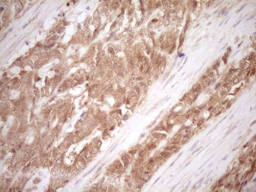 Calcitonin (CALCA) Antibody in Immunohistochemistry (Paraffin) (IHC (P))