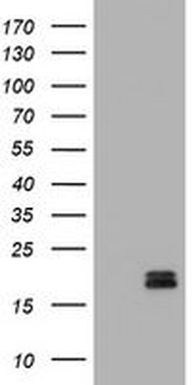 Calcitonin (CALCA) Antibody in Western Blot (WB)