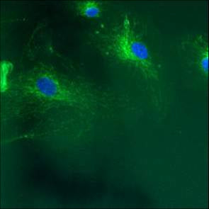 Calnexin Antibody in Immunocytochemistry (ICC/IF)