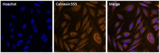 Calnexin Antibody in Immunocytochemistry (ICC/IF)