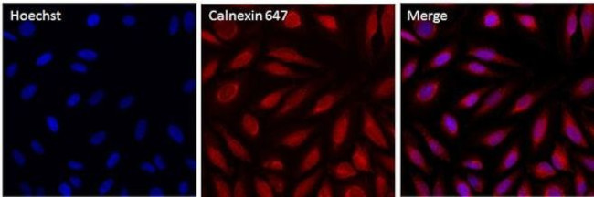 Calnexin Antibody in Immunocytochemistry (ICC/IF)