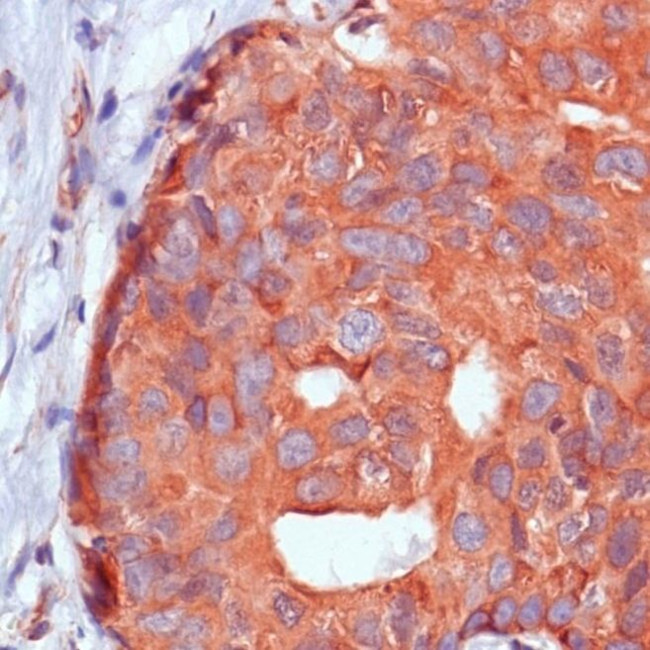 Calpastatin Antibody in Immunohistochemistry (Paraffin) (IHC (P))