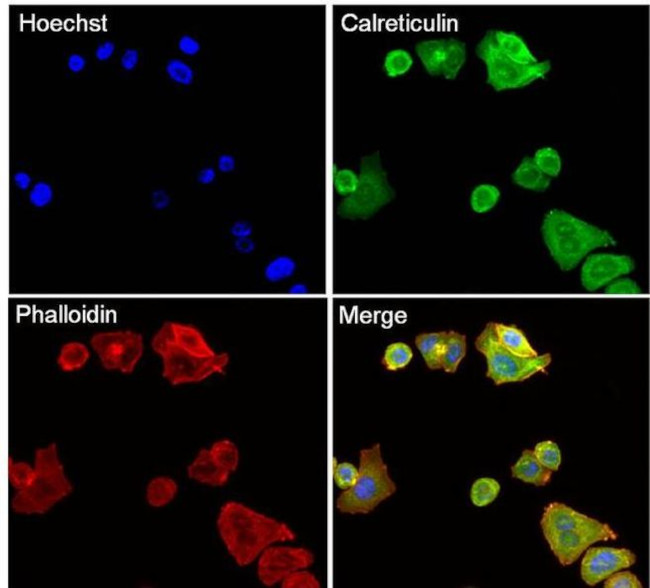 Calreticulin Antibody in Immunocytochemistry (ICC/IF)