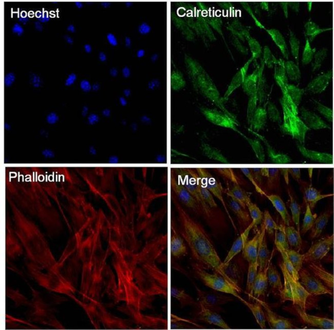 Calreticulin Antibody in Immunocytochemistry (ICC/IF)