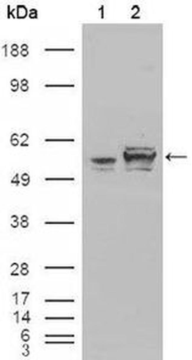 Calreticulin Antibody in Western Blot (WB)