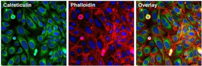 Calreticulin Antibody in Immunocytochemistry (ICC/IF)