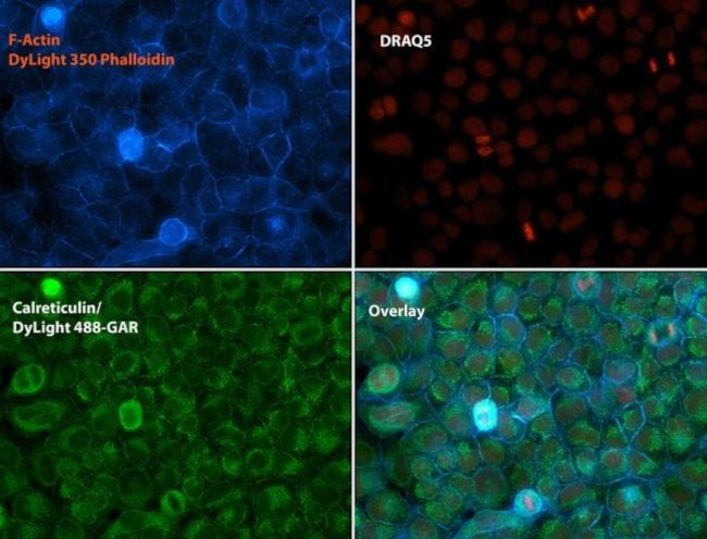 Calreticulin Antibody in Immunocytochemistry (ICC/IF)