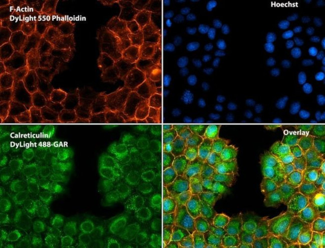 Calreticulin Antibody in Immunocytochemistry (ICC/IF)