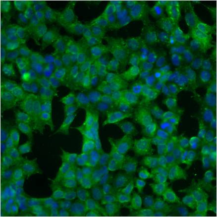 Calreticulin Antibody in Immunocytochemistry (ICC/IF)