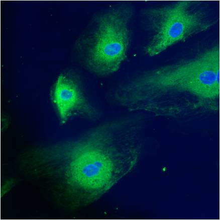 Calreticulin Antibody in Immunocytochemistry (ICC/IF)