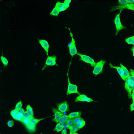 Calreticulin Antibody in Immunocytochemistry (ICC/IF)