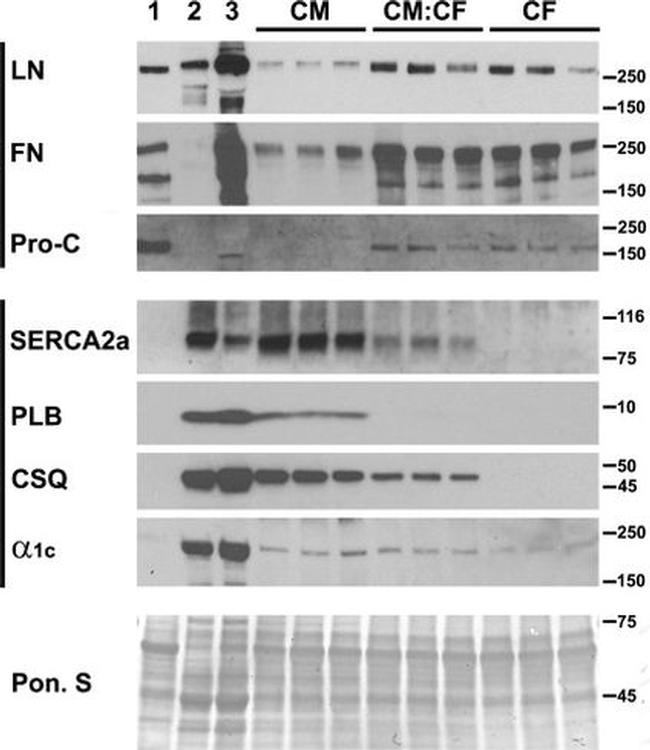 Phospholamban Antibody in Western Blot (WB)