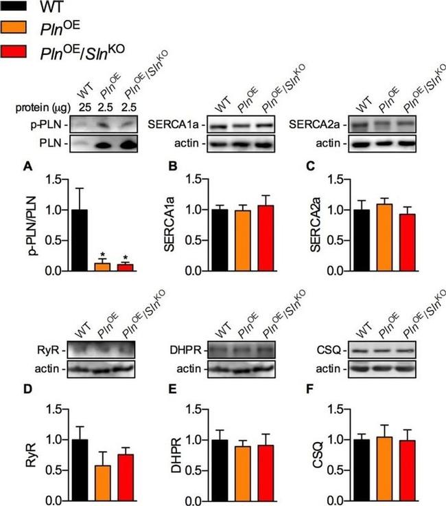 SERCA2 ATPase Antibody in Western Blot (WB)