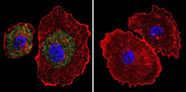 Calsequestrin Antibody in Immunocytochemistry (ICC/IF)