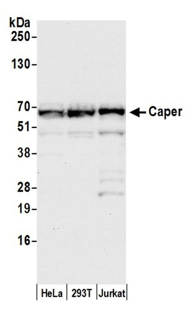 Caper Antibody in Western Blot (WB)