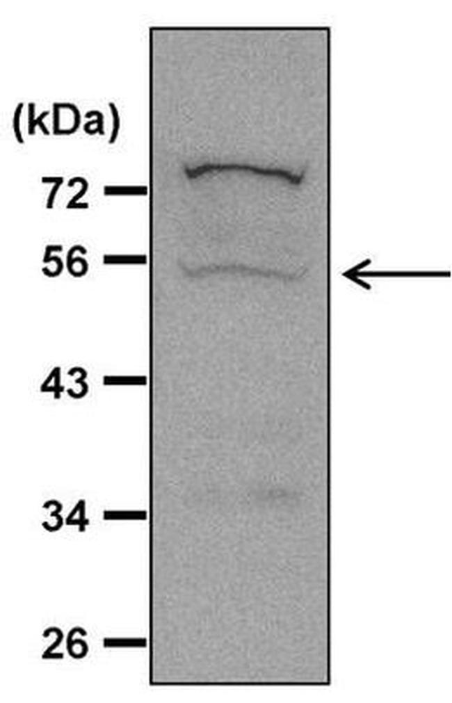 Caspase 8 Antibody in Western Blot (WB)