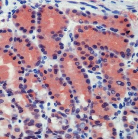 Caspase 8 Antibody in Immunohistochemistry (IHC)