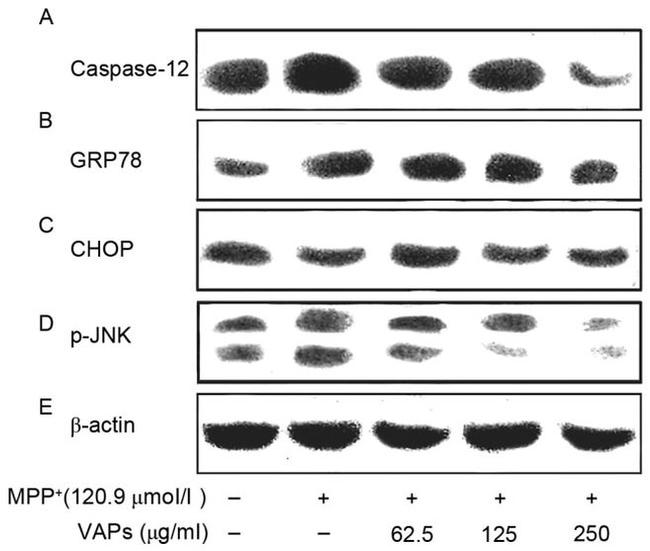 Phospho-JNK1/JNK2 (Thr183, Tyr185) Antibody in Western Blot (WB)