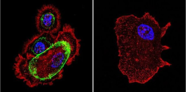 beta Catenin Antibody in Immunocytochemistry (ICC/IF)