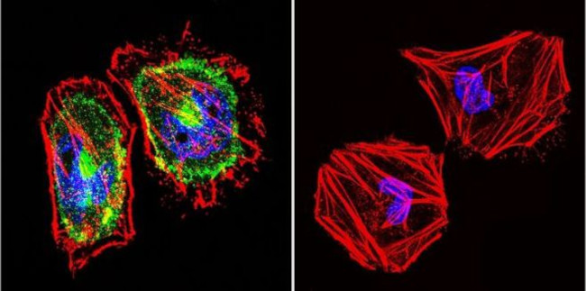 beta Catenin Antibody in Immunocytochemistry (ICC/IF)