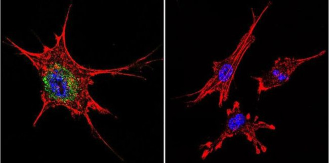 beta Catenin Antibody in Immunocytochemistry (ICC/IF)