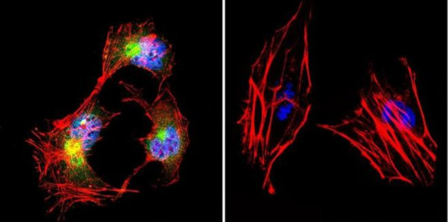 beta Catenin Antibody in Immunocytochemistry (ICC/IF)