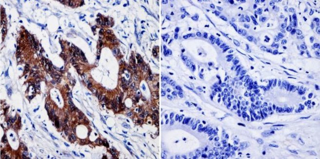 beta Catenin Antibody in Immunohistochemistry (Paraffin) (IHC (P))