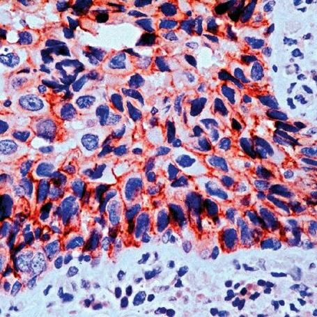 gamma Catenin Antibody in Immunohistochemistry (Paraffin) (IHC (P))