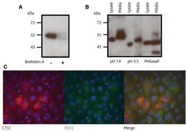 Cathepsin E Antibody in Western Blot (WB)