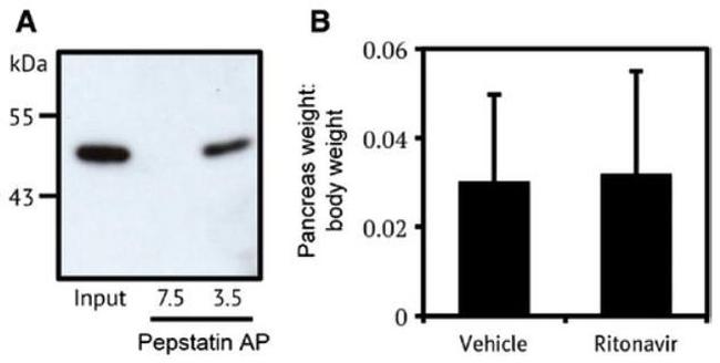 Cathepsin E Antibody in Western Blot (WB)