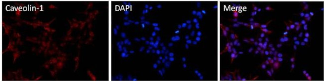 Caveolin 1 Antibody in Immunocytochemistry (ICC/IF)